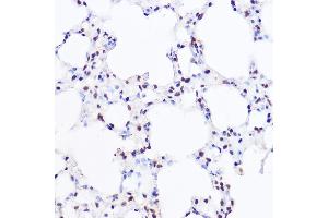 Immunohistochemistry of paraffin-embedded mouse lung using [KO Validated] BRG1/BRG1/SM Rabbit pAb (ABIN3022958, ABIN3022959, ABIN3022960 and ABIN6219317) at dilution of 1:100 (40x lens). (SMARCA4 antibody  (AA 30-130))