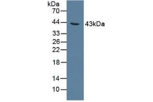Figure. (AGXT antibody  (AA 182-371))
