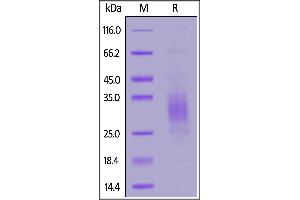 Biotinylated Human TREM2, His,Avitag™ on  under reducing (R) condition. (TREM2 Protein (AA 19-174) (His tag,AVI tag,Biotin))
