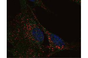 RA differentiated SH-SY5Y neuroblastoma cells were stained with Mouse Anti-Human CD107b-UNLB (LAMP2 antibody)