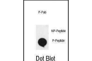 Dot blot analysis of anti-phospho-EphA2-p Phospho-specific Pab (ABIN650858 and ABIN2839809) on nitrocellulose membrane.