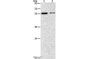 Western blot analysis of Jurkat and 293T cell, using ARHGAP15 Polyclonal Antibody at dilution of 1:500