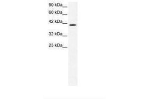 Image no. 2 for anti-CCR4 Carbon Catabolite Repression 4-Like (CCRN4L) (AA 82-131) antibody (ABIN202510) (CCRN4L antibody  (AA 82-131))