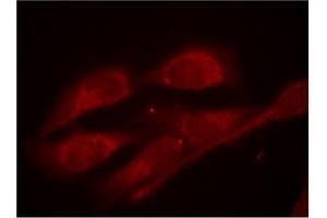 Image no. 3 for anti-SHC (Src Homology 2 Domain Containing) Transforming Protein 1 (SHC1) (pTyr427) antibody (ABIN197086) (SHC1 antibody  (pTyr427))