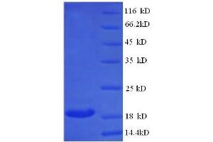 Protein expressed in E. (Butyrylcholinesterase Protein (BCHE) (AA 1-141, full length) (His tag))