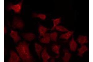 ABIN6277054 staining 293 by IF/ICC. (IKK alpha antibody  (N-Term))