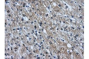 Immunohistochemistry (IHC) image for anti-Baculoviral IAP Repeat-Containing 7 (BIRC7) antibody (ABIN1499181) (BIRC7 antibody)