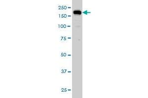 USP47 monoclonal antibody (M01), clone 5F9 Western Blot analysis of USP47 expression in HeLa . (USP47 antibody  (AA 203-301))