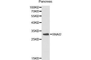 Western Blotting (WB) image for anti-Snail Family Zinc Finger 2 (SNAI2) (AA 89-268) antibody (ABIN3021318)