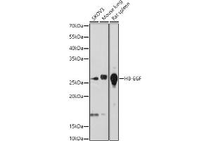 Western blot analysis of extracts of various cell lines, using HB-EGF antibody (ABIN7267616) at 1:1000 dilution. (HBEGF antibody)