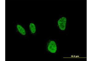 Immunofluorescence of monoclonal antibody to HOXA5 on HeLa cell. (HOXA5 antibody  (AA 171-270))