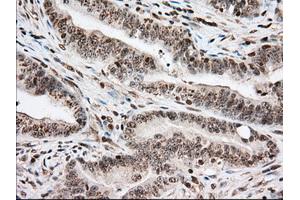 Immunohistochemical staining of paraffin-embedded Human pancreas tissue using anti-USP5 mouse monoclonal antibody. (USP5 antibody)