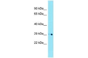 Host: Rabbit  Target Name: Dnase1l1  Sample Tissue: Mouse Heart lysates  Antibody Dilution: 1. (DNASEX antibody  (Middle Region))