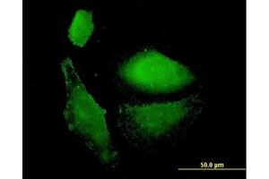 Image no. 3 for anti-Vesicle-Associated Membrane Protein 1 (Synaptobrevin 1) (VAMP1) (AA 28-97) antibody (ABIN598952) (VAMP1 antibody  (AA 28-97))