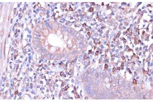 Immunohistochemistry of paraffin-embedded Human appendix using PRKACB Polyclonal Antibody at dilution of 1:100 (40x lens). (PRKACB antibody)