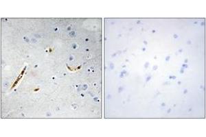 Immunohistochemistry analysis of paraffin-embedded human brain tissue, using TCF3 Antibody. (TCF3 antibody  (AA 571-620))
