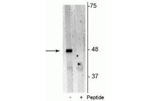 Western blot of Jurkat cell lysate showing specific immunolabeling of the ~48 kDa p62 phosphorylated at Ser28 in the first lane (-). (SQSTM1 antibody  (pSer28))