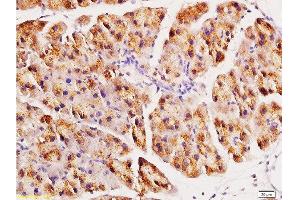 Formalin-fixed and paraffin embedded rat pancreas tissue labeled with Anti-ACE2 Polyclonal Antibody, Unconjugated at 1:200, followed by conjugation to the secondary antibody and DAB staining (ACE2 antibody  (AA 601-700))