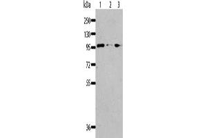 Gel: 8 % SDS-PAGE, Lysate: 40 μg, Lane 1-3: Jurkat cells, 293T cells, K562 cells, Primary antibody: ABIN7128323(AKAP8L Antibody) at dilution 1/117, Secondary antibody: Goat anti rabbit IgG at 1/8000 dilution, Exposure time: 30 seconds (AKAP8L antibody)
