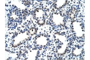 CARS antibody was used for immunohistochemistry at a concentration of 4-8 ug/ml to stain Alveolar cells (arrows) in Human Lung. (CARS antibody  (N-Term))