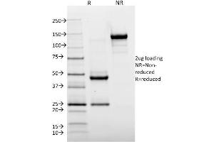 SDS-PAGE Analysis Purified HLA-DR Mouse Monoclonal Antibody (TAL 1B5). (HLA-DR antibody)