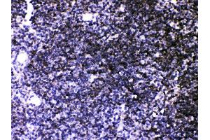 Anti- ATP2A3 antibody, IHC(P) IHC(P): Mouse Thymus Tissue (ATP2A3 antibody  (N-Term))