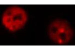 ABIN6267316 staining MOLT by IF/ICC. (Retinoblastoma 1 antibody  (pSer795))