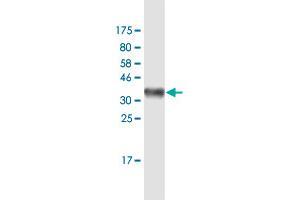 Western Blot detection against Immunogen (35. (HLA-DQB1 antibody  (AA 129-217))