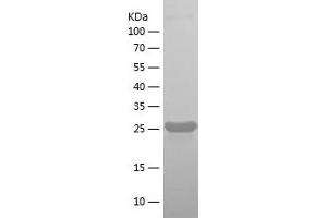 ROBO4 Protein (AA 28-235) (His tag)