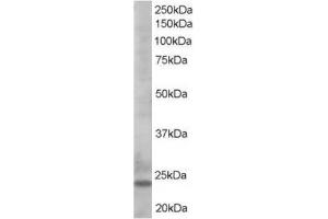Image no. 1 for anti-BCL2-Like 11 (Apoptosis Facilitator) (BCL2L11) (C-Term) antibody (ABIN374444)