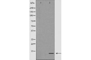 TYROBP antibody  (C-Term)