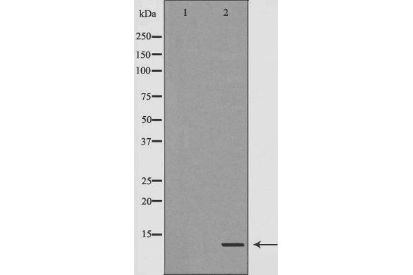 TYROBP antibody  (C-Term)