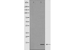 Western blot analysis of extracts of SK-SEP1 , using TYROBP antibody.