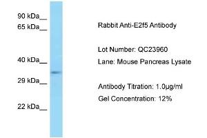 Host: Rabbit Target Name: E2f5 Sample Type: Mouse Pancreas Antibody Dilution: 1. (E2F5 antibody  (C-Term))