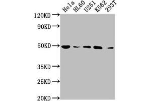 Western Blot Positive WB detected in: Hela whole cell lysate, HL60 whole cell lysate, U251 whole cell lysate, K562 whole cell lysate, 293T whole cell lysate All lanes: HDAC3 antibody at 1:2000 Secondary Goat polyclonal to rabbit IgG at 1/50000 dilution Predicted band size: 49, 50 kDa Observed band size: 49 kDa (Recombinant HDAC3 antibody)