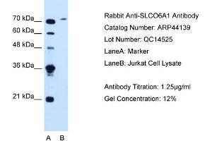 WB Suggested Anti-SLCO6A1  Antibody Titration: 1. (SLCO6A1 antibody  (C-Term))