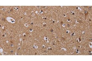 Immunohistochemistry of paraffin-embedded Human brain using MCTS1 Polyclonal Antibody at dilution of 1:60 (MCTS1 antibody)