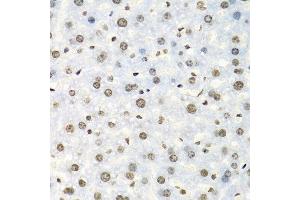 Immunohistochemistry of paraffin-embedded mouse liver using IGF2BP2 antibody at dilution of 1:100 (40x lens). (IGF2BP2 antibody)