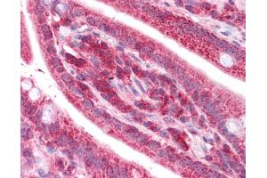 Immunohistochemistry (IHC) image for anti-Thiosulfate Sulfurtransferase (Rhodanese) (TST) (Middle Region) antibody (ABIN2777154) (TST antibody  (Middle Region))
