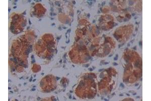 Detection of SCO2 in Human Stomach Tissue using Polyclonal Antibody to SCO Cytochrome Oxidase Deficient Homolog 2 (SCO2) (SCO2 antibody  (AA 42-266))