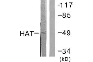 HAT antibody  (C-Term)