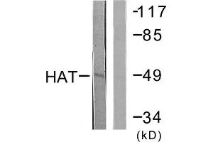 Western Blotting (WB) image for anti-Histone Acetyltransferase (HAT) (C-Term) antibody (ABIN6299416) (HAT antibody  (C-Term))