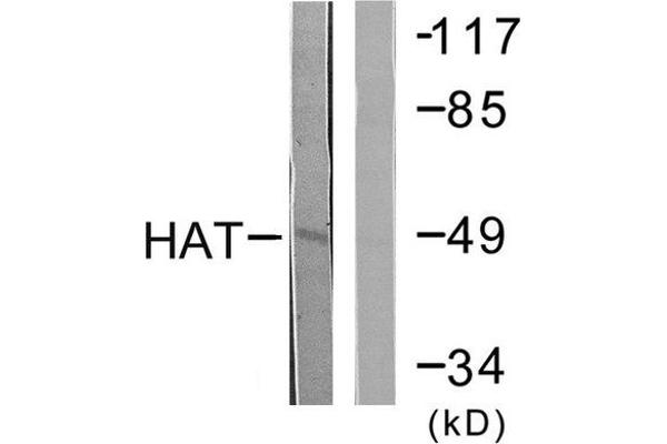 HAT 抗体  (C-Term)