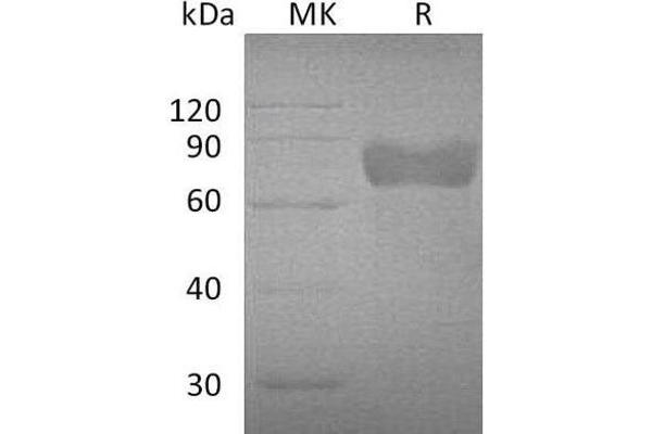 Growth Hormone Receptor Protein (GHR) (Fc Tag)