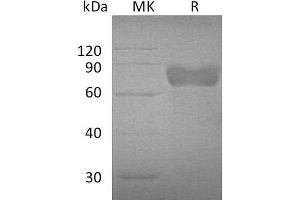 Western Blotting (WB) image for Growth Hormone Receptor (GHR) protein (Fc Tag) (ABIN7320745) (Growth Hormone Receptor Protein (GHR) (Fc Tag))