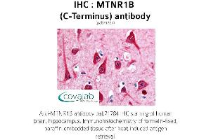 Image no. 1 for anti-Melatonin Receptor 1B (MTNR1B) (C-Term), (Cytoplasmic Domain) antibody (ABIN1737120) (Melatonin Receptor 1B antibody  (C-Term, Cytoplasmic Domain))