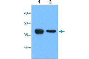 Western blot analysis of Lane 1: HepG2 cells, Lane 2: HeLa cells with ACAT1 monoclonal antibody, clone AT2C5  at 1:1000 dilution. (ACAT1 antibody  (AA 34-427))