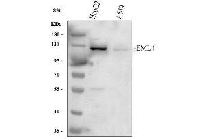 Western blot analysis of EML4 using anti-EML4 antibody (ABIN6719384). (EML4 antibody  (AA 207-423))