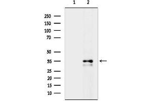 Western blot analysis of lysates from HepG2 cells(heat-shock treatment), using CCR1 Antibody.