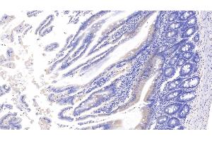 Detection of APC in Rat Small intestine Tissue using Polyclonal Antibody to Adenomatosis Polyposis Coli Protein (APC) (APC antibody  (AA 2634-2842))